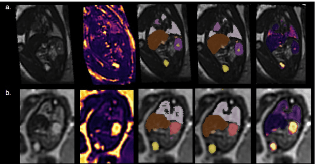 Figure 1 for An automated pipeline for quantitative T2* fetal body MRI and segmentation at low field