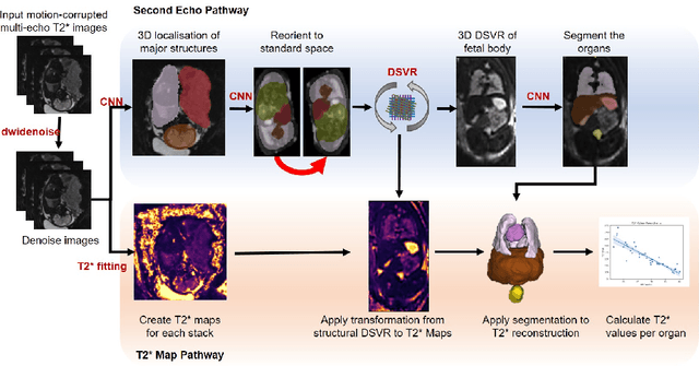 Figure 3 for An automated pipeline for quantitative T2* fetal body MRI and segmentation at low field