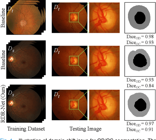 Figure 1 for Reconstruction-driven Dynamic Refinement based Unsupervised Domain Adaptation for Joint Optic Disc and Cup Segmentation