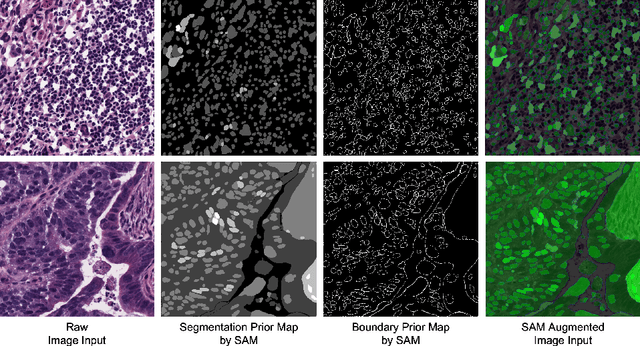 Figure 3 for Input Augmentation with SAM: Boosting Medical Image Segmentation with Segmentation Foundation Model