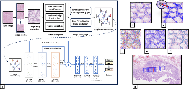 Figure 1 for C2P-GCN: Cell-to-Patch Graph Convolutional Network for Colorectal Cancer Grading