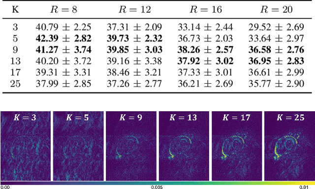 Figure 3 for Reconstruction-driven motion estimation for motion-compensated MR CINE imaging