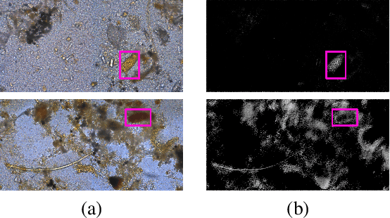 Figure 1 for A Flyweight CNN with Adaptive Decoder for Schistosoma mansoni Egg Detection