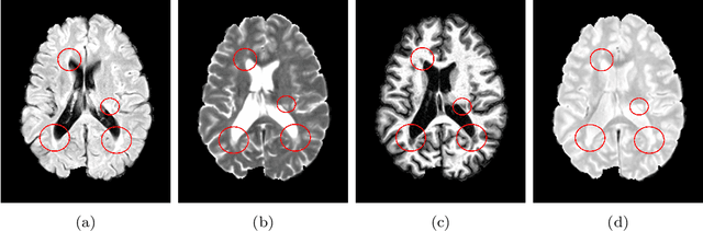 Figure 1 for Boosting multiple sclerosis lesion segmentation through attention mechanism