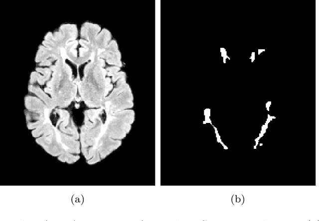 Figure 3 for Boosting multiple sclerosis lesion segmentation through attention mechanism