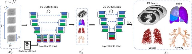 Figure 1 for MedSyn: Text-guided Anatomy-aware Synthesis of High-Fidelity 3D CT Images