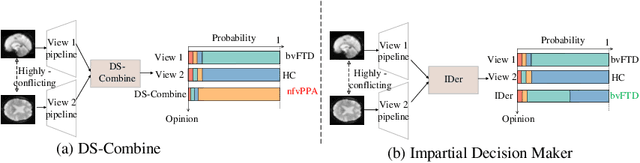 Figure 3 for A Multi-view Impartial Decision Network for Frontotemporal Dementia Diagnosis
