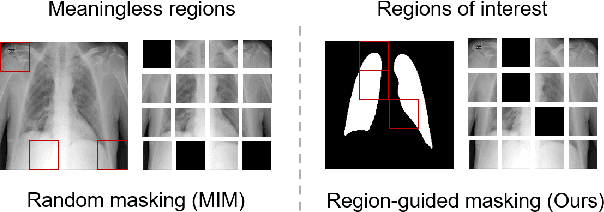 Figure 1 for RGMIM: Region-Guided Masked Image Modeling for COVID-19 Detection
