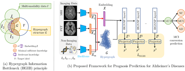 Figure 1 for HGIB: Prognosis for Alzheimer's Disease via Hypergraph Information Bottleneck
