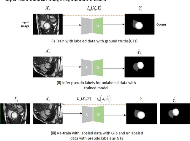 Figure 1 for Self-training with dual uncertainty for semi-supervised medical image segmentation