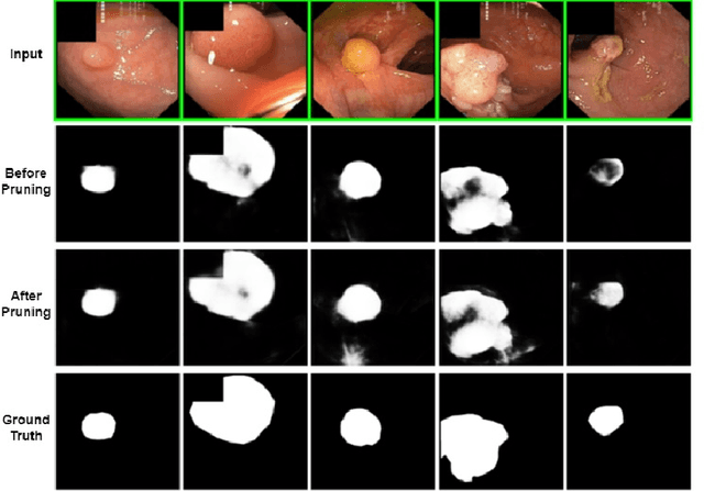 Figure 3 for Neural Network Pruning for Real-time Polyp Segmentation