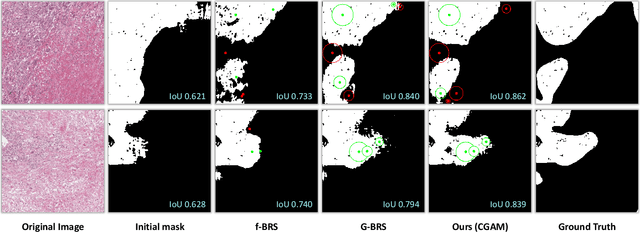Figure 3 for CGAM: Click-Guided Attention Module for Interactive Pathology Image Segmentation via Backpropagating Refinement