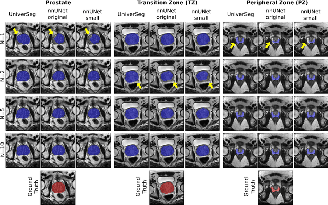 Figure 4 for Empirical Analysis of a Segmentation Foundation Model in Prostate Imaging