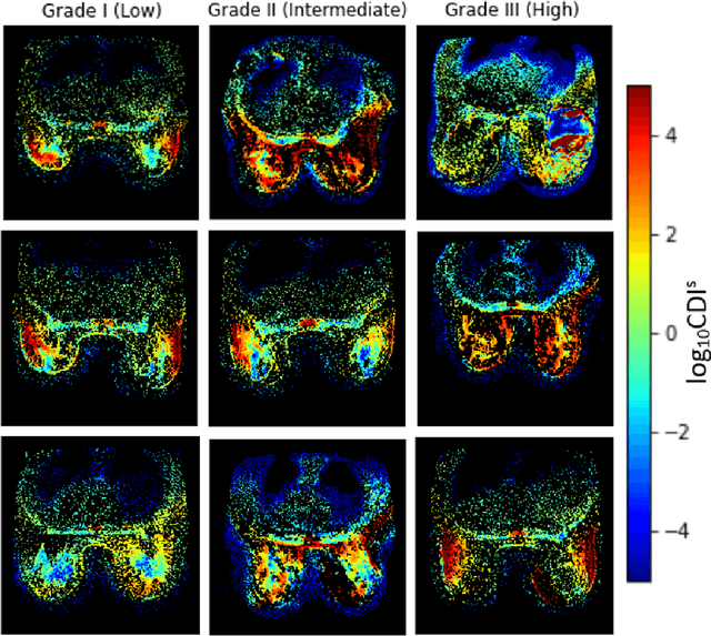 Figure 1 for A Multi-Institutional Open-Source Benchmark Dataset for Breast Cancer Clinical Decision Support using Synthetic Correlated Diffusion Imaging Data