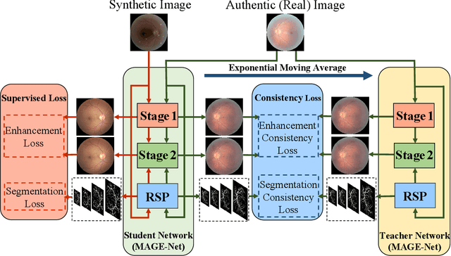 Figure 1 for Bridging Synthetic and Real Images: a Transferable and Multiple Consistency aided Fundus Image Enhancement Framework