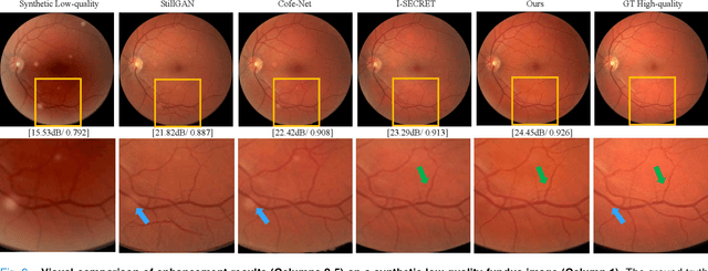 Figure 3 for Bridging Synthetic and Real Images: a Transferable and Multiple Consistency aided Fundus Image Enhancement Framework