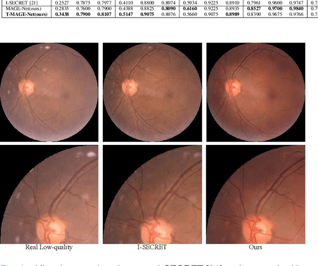 Figure 4 for Bridging Synthetic and Real Images: a Transferable and Multiple Consistency aided Fundus Image Enhancement Framework