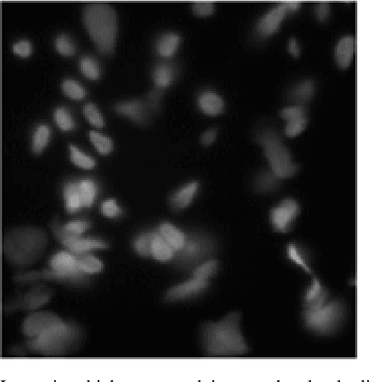 Figure 1 for A Segmentation Method for fluorescence images without a machine learning approach