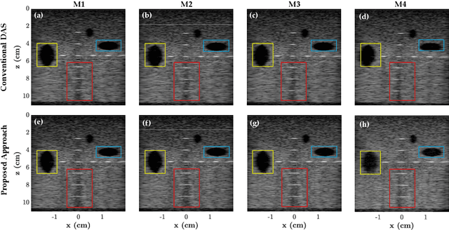 Figure 4 for Fast Marching based Tissue Adaptive Delay Estimation for Aberration Corrected Delay and Sum Beamforming in Ultrasound Imaging
