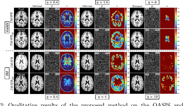 Figure 4 for Spatially-varying Regularization with Conditional Transformer for Unsupervised Image Registration