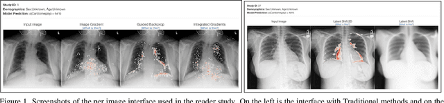 Figure 1 for The Effect of Counterfactuals on Reading Chest X-rays