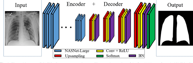 Figure 1 for Lung segmentation with NASNet-Large-Decoder Net