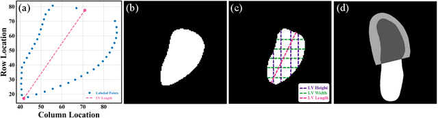Figure 1 for Development of Automated Neural Network Prediction for Echocardiographic Left ventricular Ejection Fraction