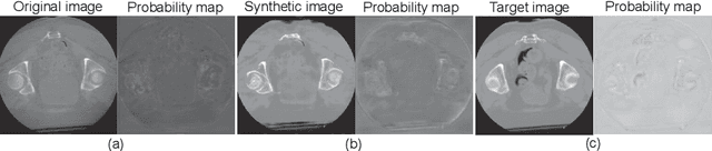 Figure 3 for Feedback Assisted Adversarial Learning to Improve the Quality of Cone-beam CT Images