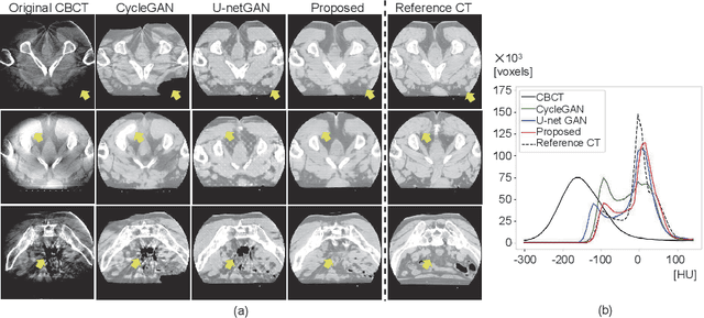 Figure 4 for Feedback Assisted Adversarial Learning to Improve the Quality of Cone-beam CT Images