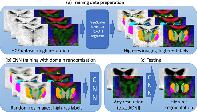 Figure 1 for Domain-agnostic segmentation of thalamic nuclei from joint structural and diffusion MRI