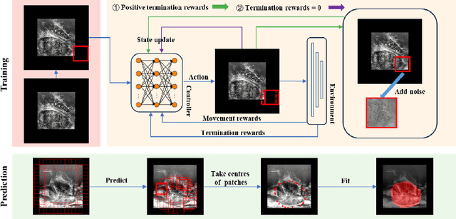 Figure 1 for Boundary-RL: Reinforcement Learning for Weakly-Supervised Prostate Segmentation in TRUS Images