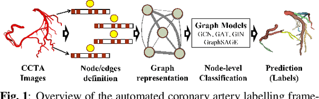 Figure 1 for Automated Coronary Arteries Labeling Via Geometric Deep Learning