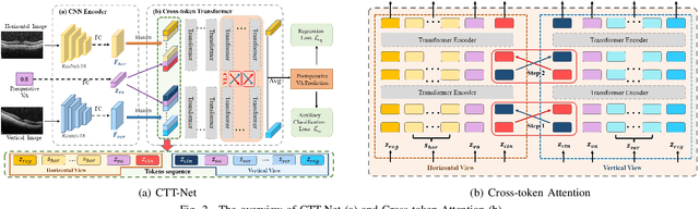 Figure 2 for CTT-Net: A Multi-view Cross-token Transformer for Cataract Postoperative Visual Acuity Prediction