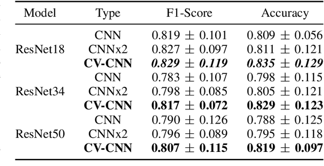 Figure 3 for Complex Network for Complex Problems: A comparative study of CNN and Complex-valued CNN