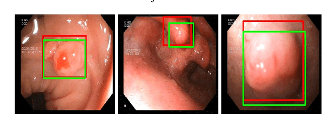 Figure 1 for Applied Deep Learning to Identify and Localize Polyps from Endoscopic Images