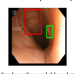 Figure 3 for Applied Deep Learning to Identify and Localize Polyps from Endoscopic Images