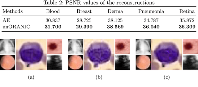 Figure 4 for unORANIC: Unsupervised Orthogonalization of Anatomy and Image-Characteristic Features