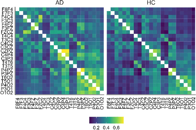 Figure 4 for Adaptive Gated Graph Convolutional Network for Explainable Diagnosis of Alzheimer's Disease using EEG Data
