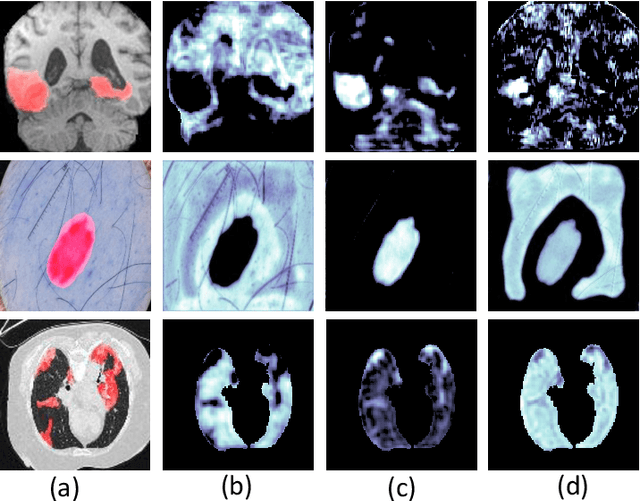 Figure 1 for Segmentation Ability Map: Interpret deep features for medical image segmentation
