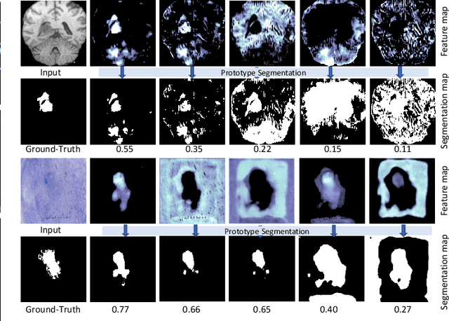 Figure 3 for Segmentation Ability Map: Interpret deep features for medical image segmentation