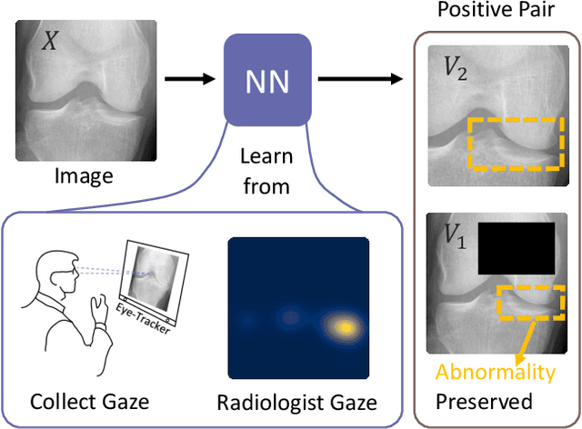 Figure 1 for Learning Better Contrastive View from Radiologist's Gaze
