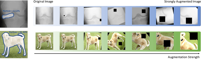 Figure 2 for Learning Better Contrastive View from Radiologist's Gaze