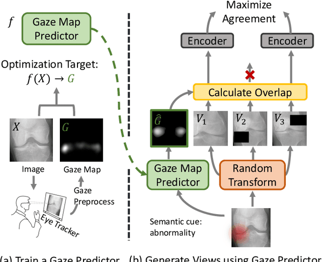 Figure 4 for Learning Better Contrastive View from Radiologist's Gaze