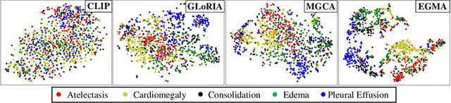 Figure 4 for Eye-gaze Guided Multi-modal Alignment Framework for Radiology