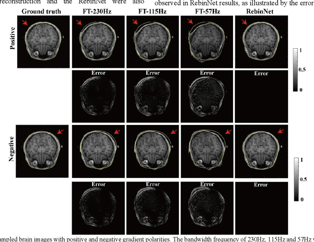 Figure 3 for Image Reconstruction with B0 Inhomogeneity using an Interpretable Deep Unrolled Network on an Open-bore MRI-Linac
