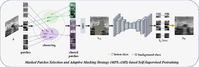 Figure 1 for MPS-AMS: Masked Patches Selection and Adaptive Masking Strategy Based Self-Supervised Medical Image Segmentation