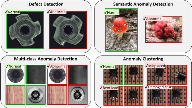Figure 1 for SelFormaly: Towards Task-Agnostic Unified Anomaly Detection