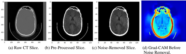 Figure 1 for Interpretable 3D Multi-Modal Residual Convolutional Neural Network for Mild Traumatic Brain Injury Diagnosis