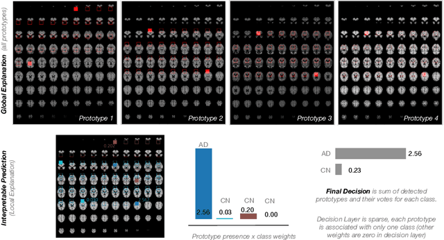 Figure 4 for PIPNet3D: Interpretable Detection of Alzheimer in MRI Scans
