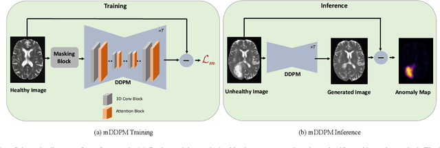 Figure 1 for Unsupervised Anomaly Detection in Medical Images Using Masked Diffusion Model